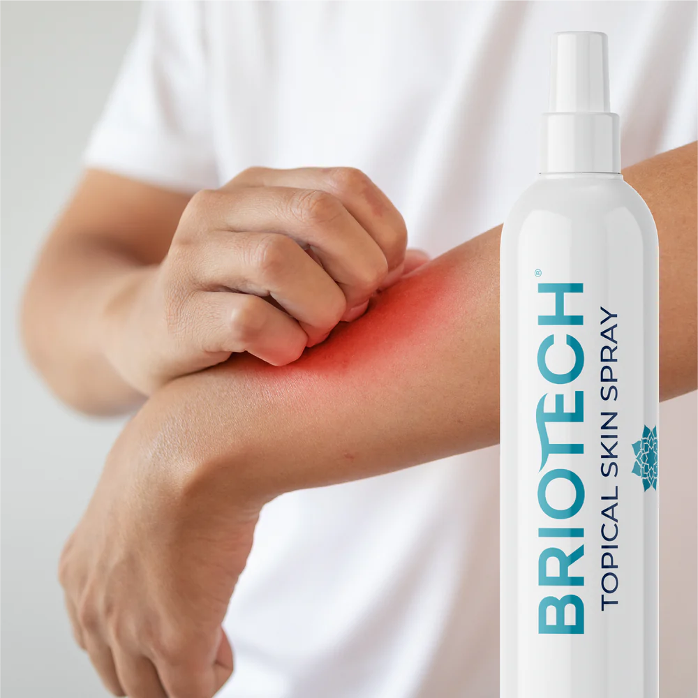 Briotech Topical Skin Spray 8 oz.
