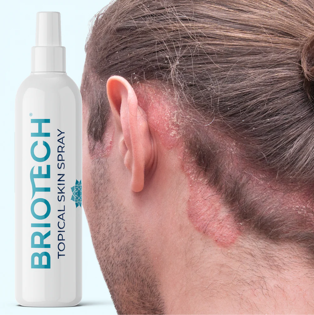 Briotech Topical Skin Spray 8 oz.